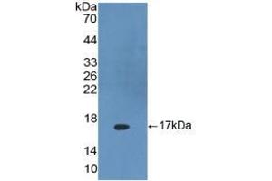 Figure. (DKK4 抗体  (AA 107-212))