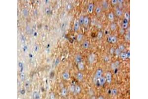 IHC-P analysis of Brain tissue, with DAB staining. (Talin 抗体  (AA 2293-2536))