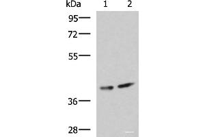 Prokineticin Receptor 2 抗体