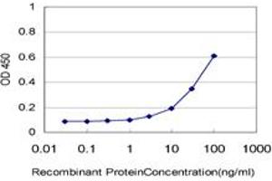 Detection limit for recombinant GST tagged IL18BP is approximately 3ng/ml as a capture antibody. (IL18BP 抗体  (AA 31-194))