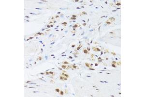 Immunohistochemistry of paraffin-embedded human stomach using GABPB1 Antibody (ABIN2562720) at dilution of 1:100 (40x lens). (GABPB1 抗体)