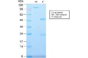 SDS-PAGE Analysis Major Vault Protein Rabbit Recombinant Monoclonal Antibody (VP2897R). (Recombinant MVP 抗体)
