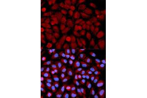 Immunofluorescence analysis of U2OS cell using MAPK9 antibody. (JNK2 抗体  (AA 1-424))