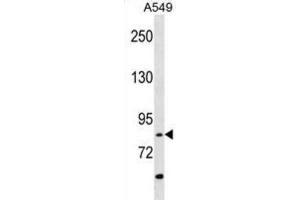 Western Blotting (WB) image for anti-Receptor-Interacting Serine-threonine Kinase 4 (RIPK4) antibody (ABIN3003506) (RIPK4 抗体)