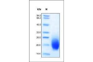 Human GM-CSF on SDS-PAGE under reducing (R) condition. (GM-CSF Protein (AA 18-144))