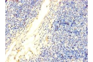 Immunohistochemistry of paraffin-embedded human thymus tissue using DNTT antibody at dilution of 1:100. (TdT 抗体  (AA 1-509))