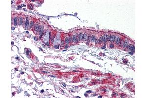 Immunohistochemistry (IHC) image for anti-Activin A Receptor, Type IB (ACVR1B) (C-Term) antibody (ABIN1099822)