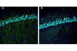 Expression of EphA3 in rat and mouse hippocampus - Immunohistochemical staining of perfusion-fixed frozen rat and mouse brain sections with Anti-EphA3 (extracellular) Antibody (ABIN7043123, ABIN7044245 and ABIN7044246), (1:200), followed by goat anti-rabbit-AlexaFluor-488. (EPH Receptor A3 抗体  (Extracellular, N-Term))