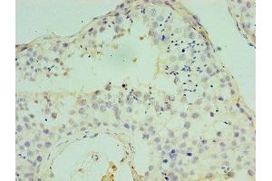 Immunohistochemistry (IHC) image for anti-Activating Transcription Factor 7 (ATF7) (AA 1-117) antibody (ABIN7148809)