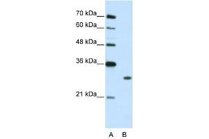 WB Suggested Anti-MBNL1  Antibody Titration: 2. (MBNL1 抗体  (C-Term))