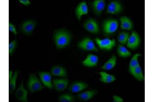 Immunofluorescence staining of A549 cells with ABIN7146688 at 1:100, counter-stained with DAPI. (CHST3 抗体  (AA 316-427))