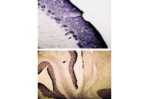 Expression of IP3R1 in mouse cerebellum - Immunohistochemical staining of mouse cerebellum with Anti-IP3 Receptor-1 (ITPR1) Antibody (ABIN7043287, ABIN7043972 and ABIN7043973).