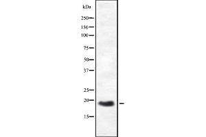 Western blot analysis of HES3 expression in HEK293 cells ,The lane on the left is treated with the antigen-specific peptide. (HES3 抗体  (N-Term))