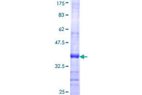 HYAL2 Protein (AA 340-439) (GST tag)