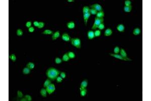 Immunofluorescence staining of PC-3 cells with ABIN7164696 at 1:66, counter-stained with DAPI. (PDCD6 抗体  (AA 1-191))