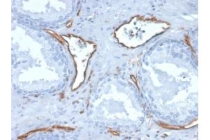 Formalin-fixed, paraffin-embedded human prostate stained with CD31 Mouse Monoclonal Antibody (PECAM1/3527).