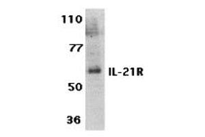 Western Blotting (WB) image for anti-Interleukin 21 Receptor (IL21R) (Extracellular Domain) antibody (ABIN1030836)