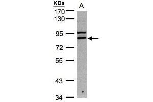 WB Image Sample A: 30μg of Hep G2 whole cell lysate , 7. (FASTKD1 抗体)