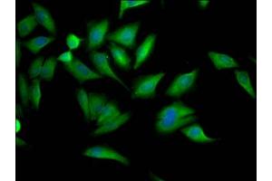 Immunofluorescence staining of Hela Cells with ABIN7127669 at 1:50, counter-stained with DAPI. (Recombinant PCYT1A 抗体)