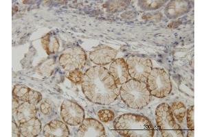 Immunoperoxidase of monoclonal antibody to TLN1 on formalin-fixed paraffin-embedded human small Intestine. (TLN1 抗体  (AA 1052-1149))