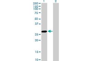 Western Blot analysis of CCBL1 expression in transfected 293T cell line by CCBL1 monoclonal antibody (M02), clone 1B12. (CCBL1 抗体  (AA 1-374))