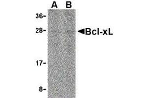 Western Blotting (WB) image for anti-BCL2-Like 1 (BCL2L1) (C-Term) antibody (ABIN2477605) (BCL2L1 抗体  (C-Term))