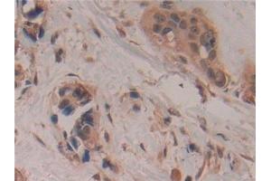 Immunohistochemistry (IHC) image for anti-Growth Associated Protein 43 (GAP43) (AA 1-274) antibody (ABIN7433477)