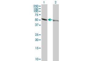 Western Blot analysis of TUBA1 expression in transfected 293T cell line by TUBA1 monoclonal antibody (M04), clone 1E11. (TUBA4A 抗体  (AA 1-448))