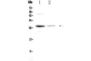Western blot analysis of Oncostatin M using anti-Oncostatin M antibody . (Oncostatin M 抗体  (AA 25-206))