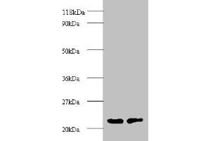 Western blot All lanes: proteasome subunit beta type-2 antibody at 2 μg/mL Lane 1: EC109 whole cell lysate Lane 2: 293T whole cell lysate Secondary Goat polyclonal to rabbit IgG at 1/15000 dilution Predicted band size: 23 kDa Observed band size: 23 kDa