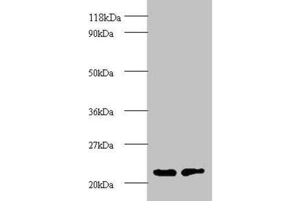 PSMB2 抗体  (AA 1-201)