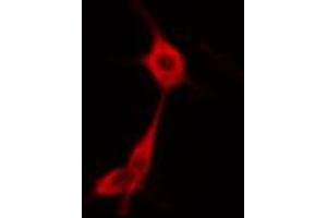 ABIN6274669 staining HuvEc cells by IF/ICC. (GBP1 抗体  (C-Term))