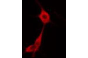 ABIN6274669 staining HuvEc cells by IF/ICC. (GBP1 抗体  (C-Term))