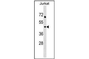 Western blot analysis using CD208 / LAMP3 Antibody (N-term) in Jurkat cell line lysates (35ug/lane). (LAMP3 抗体  (N-Term))