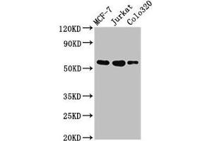 Western Blot Positive WB detected in: MCF-7 whole cell lysate, Jurkat whole cell lysate, Colo320 whole cell lysate All lanes: IRX4 antibody at 3 μg/mL Secondary Goat polyclonal to rabbit IgG at 1/50000 dilution Predicted band size: 55, 58 kDa Observed band size: 55 kDa (IRX4 抗体  (AA 287-363))