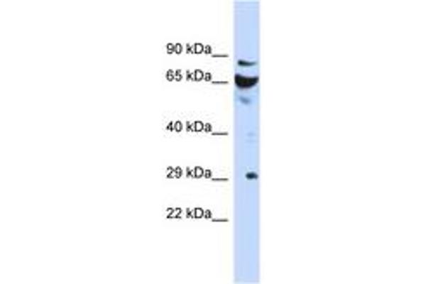 DCUN1D3 anticorps  (AA 35-84)