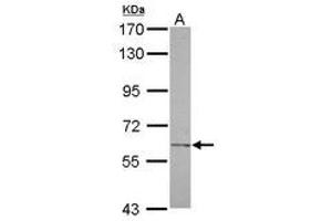 Image no. 1 for anti-Carbohydrate (N-Acetylglucosamine-6-O) Sulfotransferase 2 (CHST2) (AA 246-469) antibody (ABIN1497516) (CHST2 抗体  (AA 246-469))