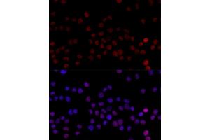 Immunofluorescence analysis of 293T cells using HNRNPL antibody (ABIN6128048, ABIN6141915, ABIN6141917 and ABIN6216076) at dilution of 1:100 (40x lens).