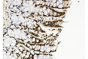 ABIN6261115 and ABIN6266521 at 1/100 staining Rat stomach tissue by IHC-P.