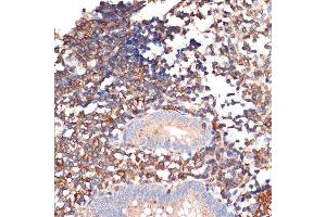 Immunohistochemistry of paraffin-embedded human appendix using EHD1 Rabbit mAb (ABIN7266911) at dilution of 1:100 (40x lens). (EHD1 抗体)
