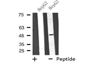 Western blot analysis of extracts from HepG2 cells using ATP6V1C2 antibody. (ATP6V1C2 抗体  (Internal Region))