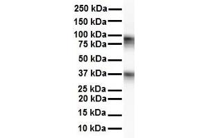 WB Suggested Anti-CPEB4 antibody Titration: 1 ug/mL Sample Type: Human Raji (CPEB4 抗体  (N-Term))