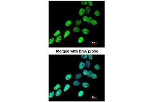 AP19043PU-N hnRNP-F antibody staining of Paraformaldehyde-fixed A431 by Immunofluorescence at 1/200 dilution. (HNRNPF 抗体  (N-Term))