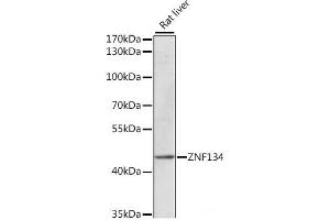 Western blot analysis of extracts of Rat liver using ZNF134 Polyclonal Antibody at dilution of 1:1000. (ZNF134 抗体)