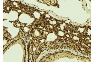 ABIN6267140 at 1/100 staining Mouse lung tissue by IHC-P. (MSK1 抗体  (pSer360))