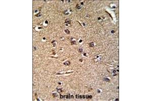 Immunohistochemistry (Paraffin-embedded Sections) (IHC (p)) image for anti-gamma-Glutamyltransferase 5 (GGT5) (AA 130-156), (N-Term) antibody (ABIN391586)