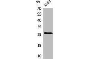 Western Blot analysis of K562 cells using FGF-8 Polyclonal Antibody. (FGF8 抗体  (Internal Region))