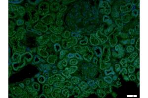 Paraformaldehyde-fixed, paraffin embedded Human kidney, Antigen retrieval by boiling in sodium citrate buffer (pH6. (CECR1 抗体  (AA 450-500))