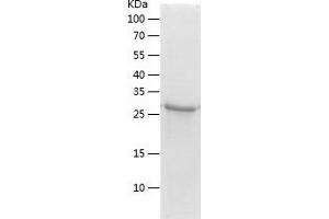 Western Blotting (WB) image for SGT1, Suppressor of G2 Allele of SKP1 (SUGT1) (AA 115-365) protein (His tag) (ABIN7125074) (SUGT1 Protein (AA 115-365) (His tag))