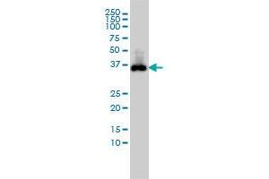 CDX2 monoclonal antibody (M01), clone 1C7 Western Blot analysis of CDX2 expression in COLO 320 HSR .